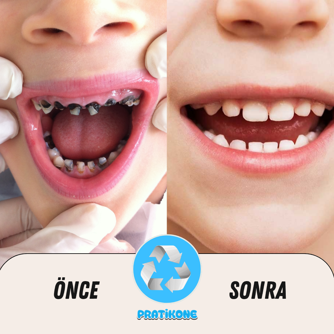 Pratikone U Şeklinde Şarjlı Çocuk Diş Fırçası 