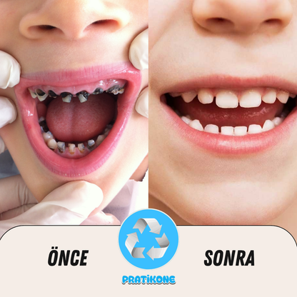 Pratikone U Şeklinde Şarjlı Çocuk Diş Fırçası 